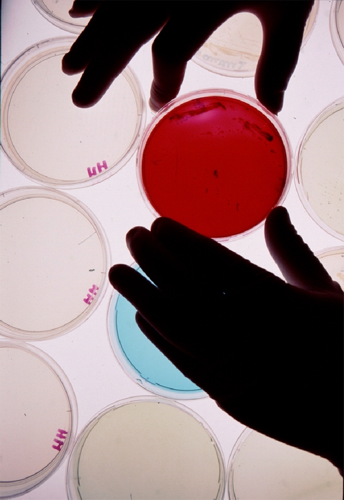 Rilevamento dei batteri tramite analisi di laboratorio (HPC conta in piastra degli eterotrofi)